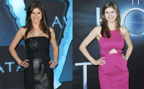 Alexandra Daddario Breast Job – Before and After Pictures